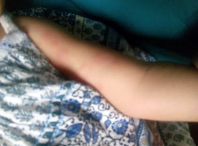 El PSOE exige actuaciones urgentes ante la plaga de pulgas en el nuevo parque de San Diego