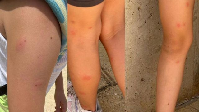 Jódar: 'Exigimos la fumigación inmediata en los colegios de Lorca para erradicar las plagas de insectos que tiene a nuestros menores llenos de picaduras'