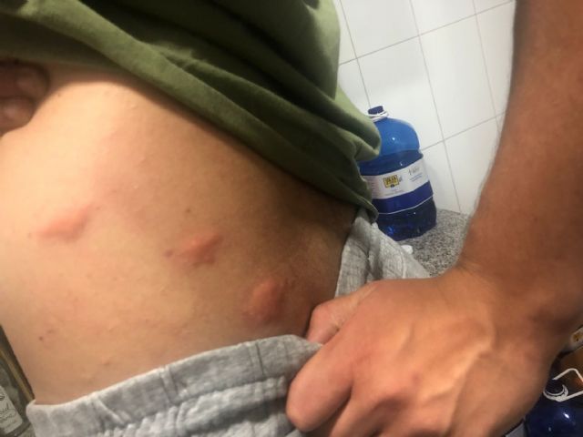 El PP propone iniciar fumigaciones extraordinarias e intensas ante la preocupante proliferación de insectos, mosquitos y moscas en pedanías y casco urbano