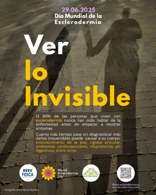 El Ayuntamiento de Lorca ilumina de verde la pasarela 'Alcalde Miguel Navarro Molina' y la fuente de San Antonio por el Día Mundial de la Esclerodermia